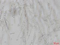 Geotrichum_sp_4