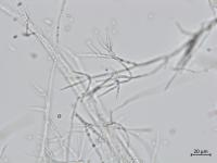 Gibellulopsis_sp_1
