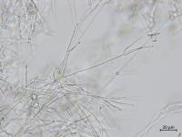 Gibellulopsis_sp_2