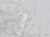 Gibellulopsis_sp_3
