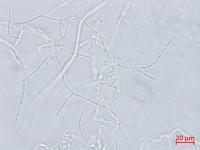 Microdochium_sp_1