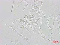 Microdochium_sp_2