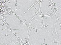 Microdochium_sp_3