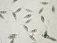 Pestalotiopsis_sp_1