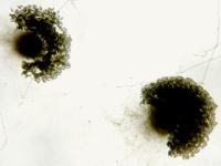 Pestalotiopsis_sp_3