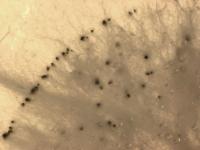 Pestalotiopsis_sp_4