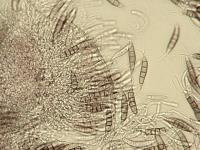 Pestalotiopsis_sp_5