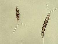 Pestalotiopsis_sp_6