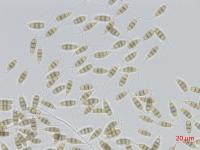 Pestalotiopsis_sp_7