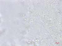 Phomopsis_sp_14