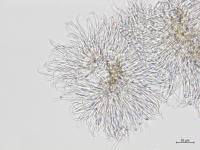 Phomopsis_sp_11