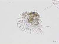 Phomopsis_sp_12