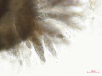 Physalospora_sp_3