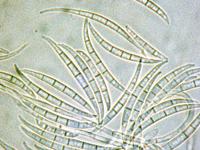 Fusarium_acuminatum_2