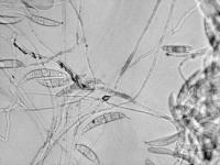 Fusarium_cerealis_1
