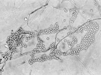 Fusarium_poae_1