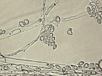 Fusarium_tricinctum_2