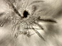 Gaeumannomyces_sp_4