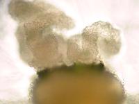 Phoma_sp_2