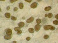 Phoma_sp_4