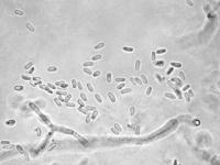 Phoma_sp_5