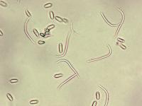 Phomopsis_sp_3