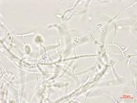 Plectosporium_tabacinum_1