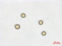 Pythium_uncinulatum_1