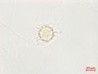 Pythium_uncinulatum_3