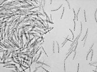 Septoria_sp_2