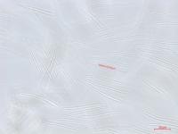 Septoria_sp_5