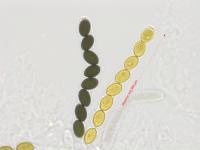 Sordaria_sp_7
