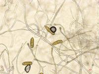 Stemphylium_sp_3