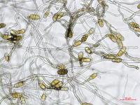 Stemphylium_sp_4