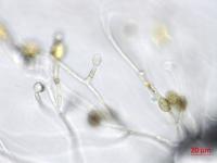 Ulocladium_sp_3