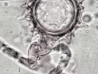 Pythium_sp_3