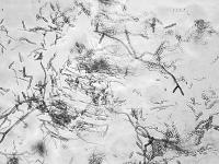 Ramularia_sp_1