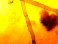 Rhizoctonia_solani_2