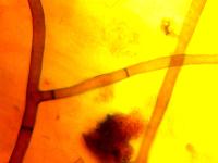 Rhizoctonia_solani_2