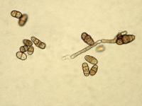 Ulocladium_sp_5