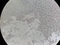 fusarium virguliforme