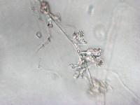 Sclerotium cepivorum conidiophores