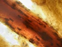 Berkeleyomyces basicola (syn. Thielaviopsis basicola) racine laitue