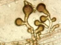 Epicoccum sp.