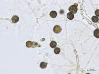 Epicoccum sp.
