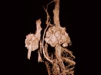 Pomme - Tumeur du collet (Agrobacterium tumefaciens)