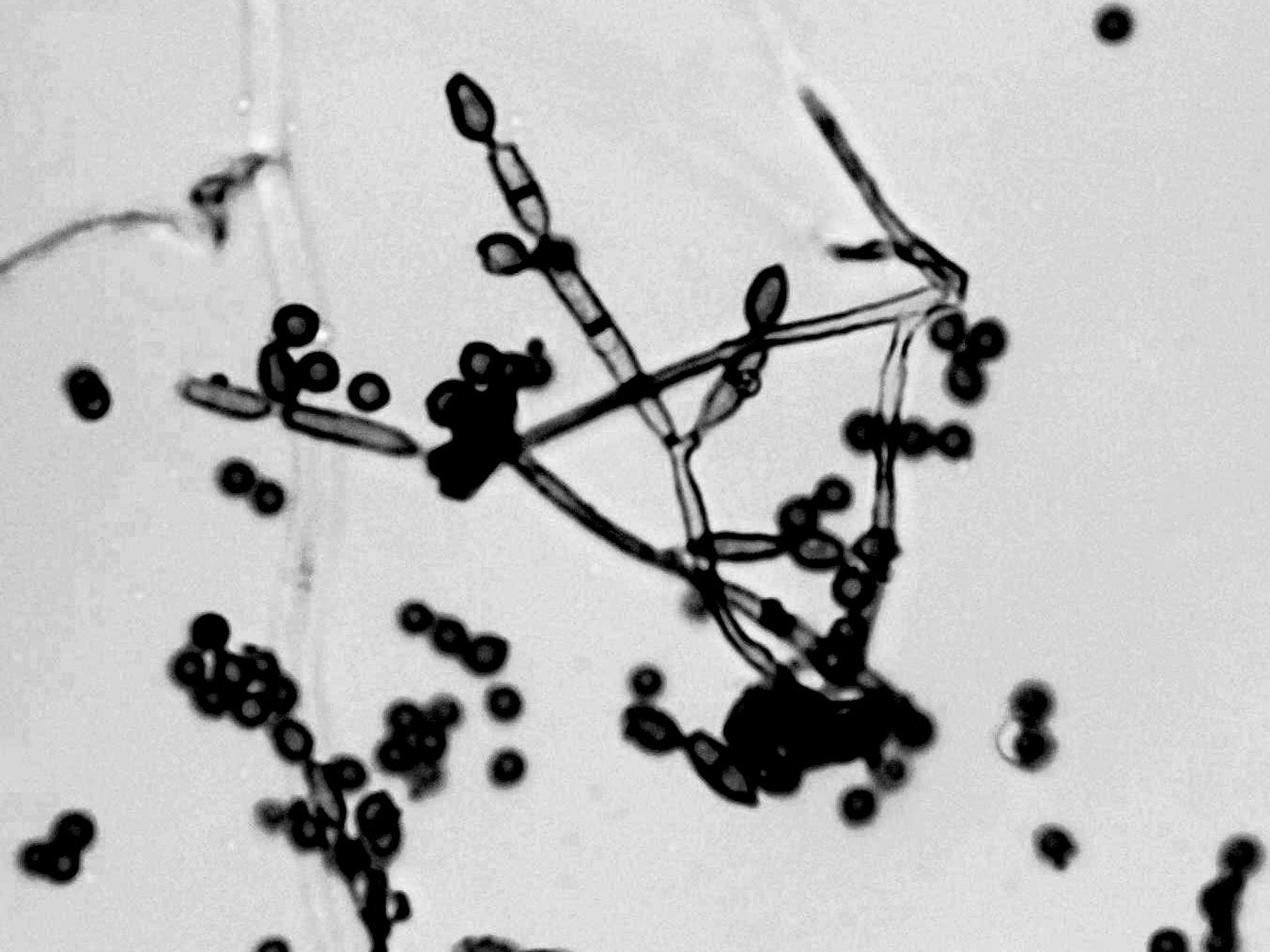 Cladosporium-13