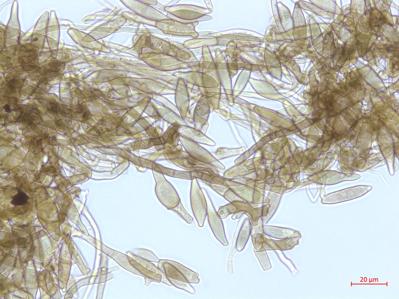 Cladosporium_D52838-2_LQ