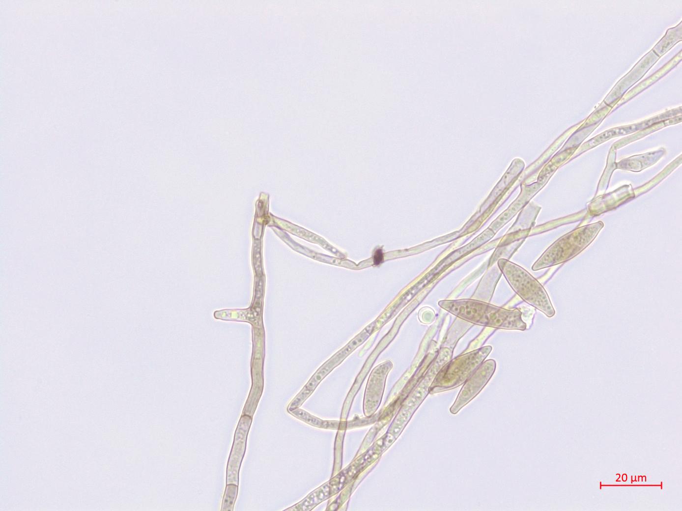 Cladosporium_D52838-3_LQ