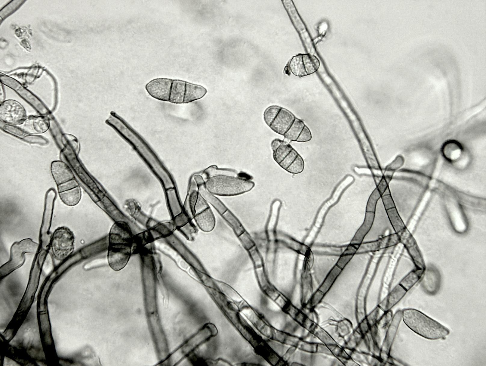 Cladosporium_brassicae-01